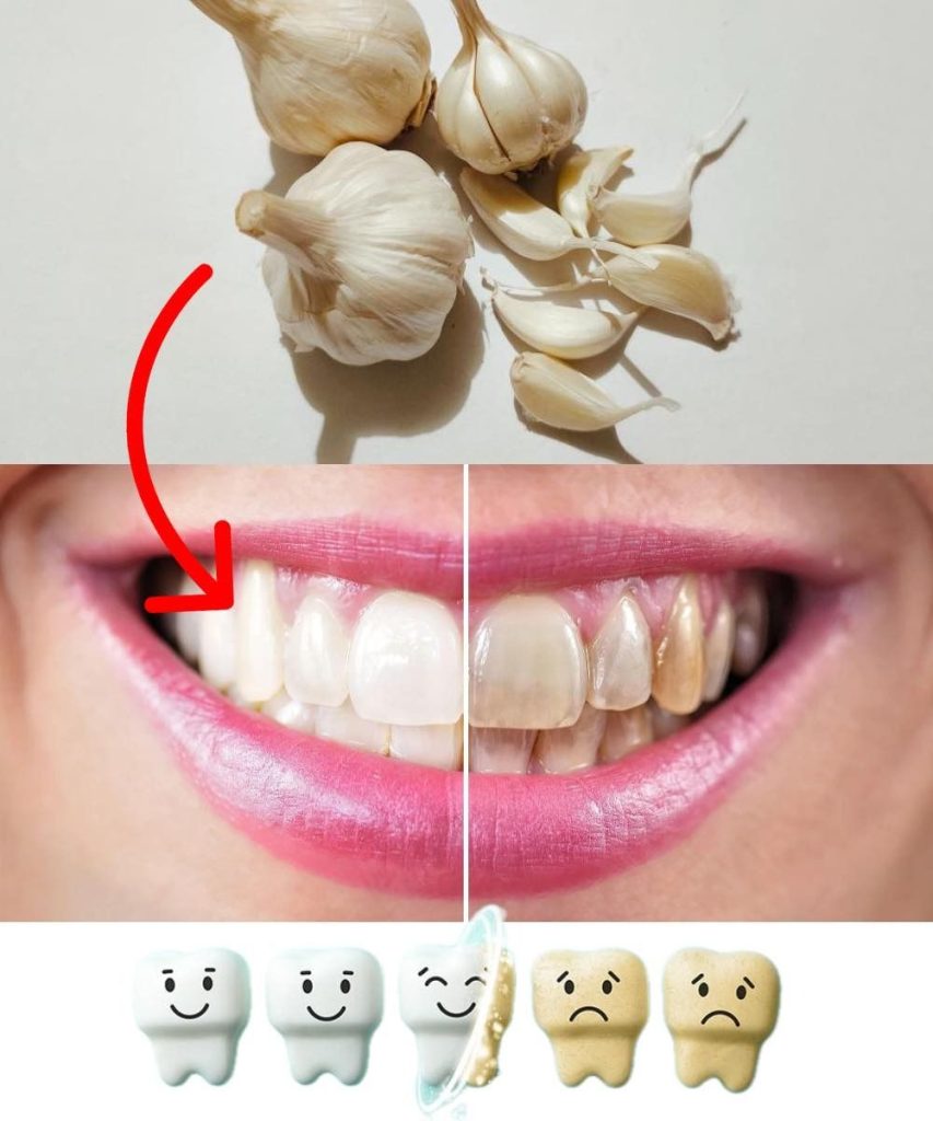 Mejora tu salud bucal de forma natural con ajo.